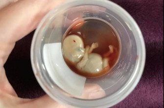 El controversial tema del aborto