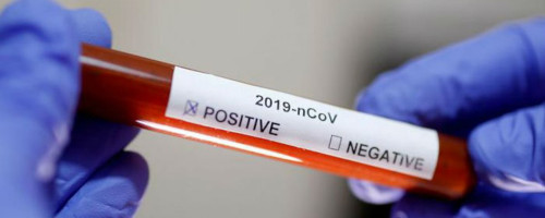 Pruebas de laboratorio con reactivos en duda